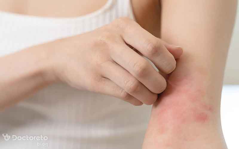 عوارض پوستی دیابت